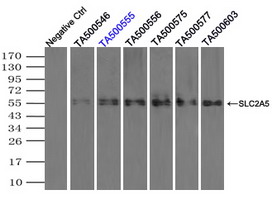 SLC2A5 / GLUT5 Antibody - Immunoprecipitation(IP) of SLC2A5 by using monoclonal anti-SLC2A5 antibodies (Negative control: IP without adding anti-SLC2A5 antibody.). For each experiment, 500ul of DDK tagged SLC2A5 overexpression lysates (at 1:5 dilution with HEK293T lysate), 2 ug of anti-SLC2A5 antibody and 20ul (0.1 mg) of goat anti-mouse conjugated magnetic beads were mixed and incubated overnight. After extensive wash to remove any non-specific binding, the immuno-precipitated products were analyzed with rabbit anti-DDK polyclonal antibody.