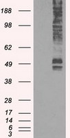 SLC2A5 / GLUT5 Antibody - HEK293T cells were transfected with the pCMV6-ENTRY control (Left lane) or pCMV6-ENTRY SLC2A5 (Right lane) cDNA for 48 hrs and lysed. Equivalent amounts of cell lysates (5 ug per lane) were separated by SDS-PAGE and immunoblotted with anti-SLC2A5.