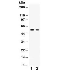 SLC2A5 / GLUT5 Antibody