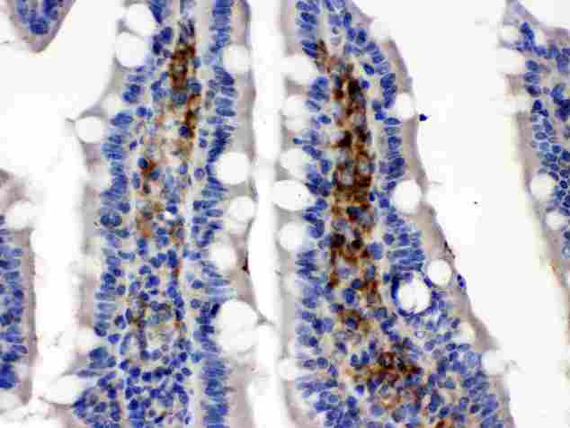 SLC2A5 / GLUT5 Antibody - SLC2A5 was detected in paraffin-embedded sections of rat intestine cancer tissues using rabbit anti-SLC2A5 Antigen Affinity purified polyclonal antibody