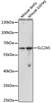 SLC2A5 / GLUT5 Antibody - Western blot analysis of extracts of various cell lines, using SLC2A5 antibody at 1:1000 dilution. The secondary antibody used was an HRP Goat Anti-Rabbit IgG (H+L) at 1:10000 dilution. Lysates were loaded 25ug per lane and 3% nonfat dry milk in TBST was used for blocking. An ECL Kit was used for detection and the exposure time was 20s.