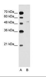 SLC2A6 / GLUT6 Antibody - A: Marker, B: Jurkat Cell Lysate.  This image was taken for the unconjugated form of this product. Other forms have not been tested.