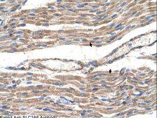 SLC2A6 / GLUT6 Antibody - SLC2A6 / GLUT9 antibody ARP43974_T100-NP_060055-SLC2A6(solute carrier family 2 (facilitated glucose transporter), member 6) Antibody was used in IHC to stain formalin-fixed, paraffin-embedded human muscle.  This image was taken for the unconjugated form of this product. Other forms have not been tested.