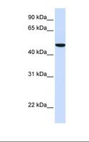 SLC2A6 / GLUT6 Antibody - Fetal liver lysate. Antibody concentration: 1.0 ug/ml. Gel concentration: 12%.  This image was taken for the unconjugated form of this product. Other forms have not been tested.