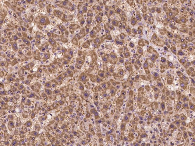 SLC2A7 / GLUT7 Antibody - Immunochemical staining of human SLC2A7 in human liver with rabbit polyclonal antibody at 1:100 dilution, formalin-fixed paraffin embedded sections.