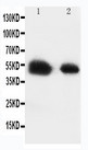 SLC2A8 / GLUT8 Antibody - WB of SLC2A8 / GLUT8 antibody. Lane 1: Rat Testis Tissue Lysate. Lane 2: Human Placenta Tissue Lysate.