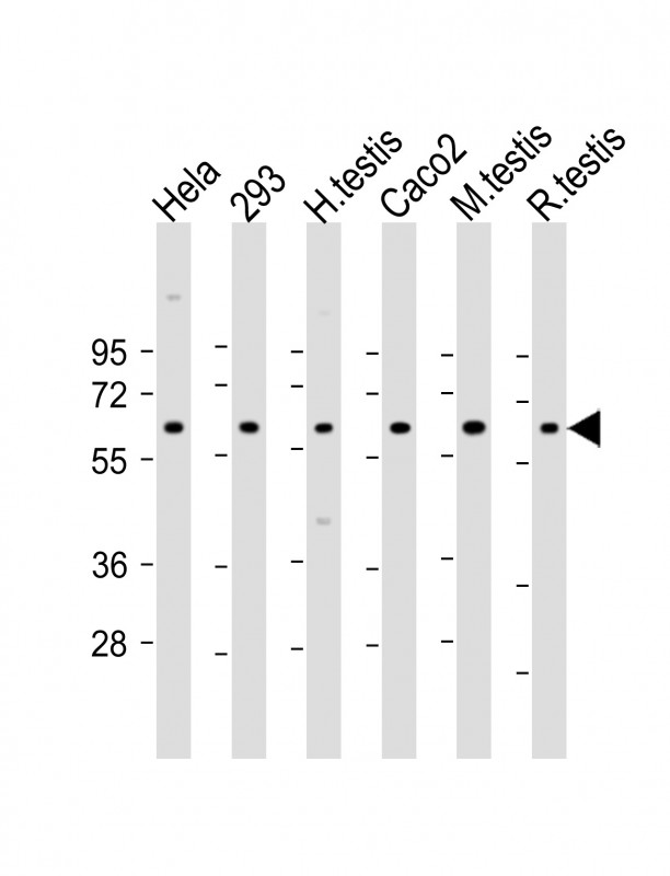 SLC2A8 / GLUT8 Antibody - All lanes: Anti-SLC2A8 Antibody (Center) at 1:2000 dilution Lane 1: Hela whole cell lysate Lane 2: 293 whole cell lysate Lane 3: human testis lysate Lane 4: Caco2 whole cell lysate Lane 5: mouse testis lysate Lane 6: rat testis lysate Lysates/proteins at 20 µg per lane. Secondary Goat Anti-Rabbit IgG, (H+L), Peroxidase conjugated at 1/10000 dilution. Predicted band size: 51 kDa Blocking/Dilution buffer: 5% NFDM/TBST.