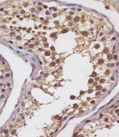 SLC2A8 / GLUT8 Antibody - SLC2A8 Antibody (Center) staining SLC2A8 in human testis tissue sections by Immunohistochemistry (IHC-P - paraformaldehyde-fixed, paraffin-embedded sections). Tissue was fixed with formaldehyde and blocked with 3% BSA for 0. 5 hour at room temperature; antigen retrieval was by heat mediation with a citrate buffer (pH6). Samples were incubated with primary antibody (1/25) for 1 hours at 37°C. A undiluted biotinylated goat polyvalent antibody was used as the secondary antibody.