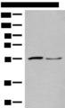 SLC2A8 / GLUT8 Antibody - Western blot analysis of Human placenta tissue and PC3 cell lysates  using SLC2A8 Polyclonal Antibody at dilution of 1:400