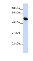 SLC2A9 / GLUT9 Antibody - SLC2A9 / GLUT9 antibody Western blot of HepG2 cell lysate. This image was taken for the unconjugated form of this product. Other forms have not been tested.