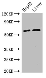 SLC2A9 / GLUT9 Antibody - Positive WB detected in:HepG2 whole cell lysate,Mouse liver tissue;All lanes:SLC2A9 antibody at 2.7?g/ml;Secondary;Goat polyclonal to rabbit IgG at 1/50000 dilution;Predicted band size: 59,56 KDa;Observed band size: 59 KDa;