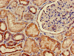 SLC2A9 / GLUT9 Antibody - Immunohistochemistry of paraffin-embedded human kidney tissue using SLC2A9 Antibody at dilution of 1:100