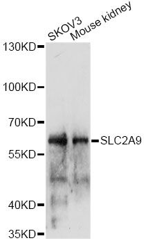 SLC2A9 / GLUT9 Antibody - Western blot analysis of extracts of various cell lines, using SLC2A9 antibody at 1:1000 dilution. The secondary antibody used was an HRP Goat Anti-Rabbit IgG (H+L) at 1:10000 dilution. Lysates were loaded 25ug per lane and 3% nonfat dry milk in TBST was used for blocking. An ECL Kit was used for detection and the exposure time was 6min.