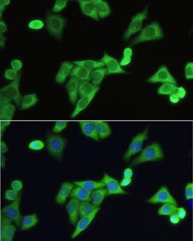 SLC2A9 / GLUT9 Antibody - Immunofluorescence analysis of HeLa cells using SLC2A9 antibody at dilution of 1:100. Blue: DAPI for nuclear staining.
