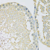 SLC2A9 / GLUT9 Antibody - Immunohistochemistry of paraffin-embedded rat testis using SLC2A9 antibody at dilution of 1:100 (40x lens).