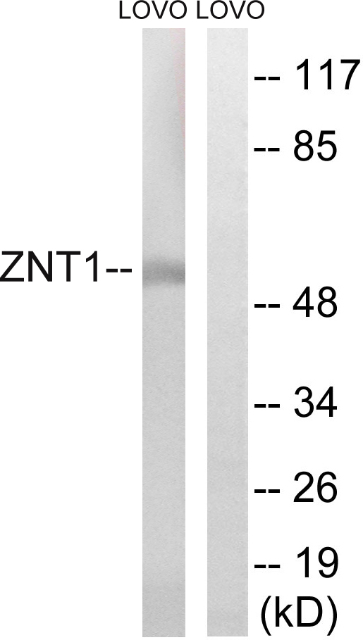 SLC30A1 / ZNT1 Antibody - Western blot analysis of lysates from LOVO cells, using SLC30A1 Antibody. The lane on the right is blocked with the synthesized peptide.