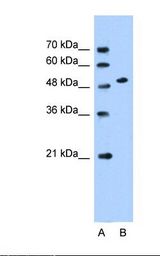 SLC30A1 / ZNT1 Antibody - Lane A: Marker. Lane B: HepG2 cell lysate. Antibody concentration: 0.25 ug/ml. Gel concentration: 12%.  This image was taken for the unconjugated form of this product. Other forms have not been tested.