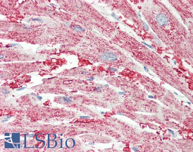 SLC30A1 / ZNT1 Antibody - Anti-SLC30A1 antibody IHC staining of human heart. Immunohistochemistry of formalin-fixed, paraffin-embedded tissue after heat-induced antigen retrieval. Antibody concentration 10 ug/ml.  This image was taken for the unconjugated form of this product. Other forms have not been tested.