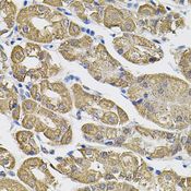 SLC30A1 / ZNT1 Antibody - Immunohistochemistry of paraffin-embedded human stomach using SLC30A1 antibody (40x lens).