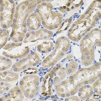 SLC30A1 / ZNT1 Antibody - Immunohistochemistry of paraffin-embedded rat kidney using SLC30A1 antibody (40x lens).