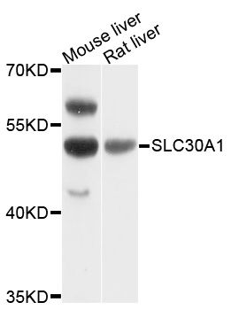 SLC30A1 / ZNT1 Antibody - Western blot analysis of extracts of various cell lines, using SLC30A1 antibody at 1:1000 dilution. The secondary antibody used was an HRP Goat Anti-Rabbit IgG (H+L) at 1:10000 dilution. Lysates were loaded 25ug per lane and 3% nonfat dry milk in TBST was used for blocking. An ECL Kit was used for detection and the exposure time was 30s.