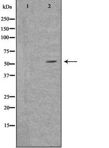 SLC30A1 / ZNT1 Antibody - Western blot analysis of extracts of LOVO cells using SLC30A1 antibody. The lane on the left is treated with the antigen-specific peptide.