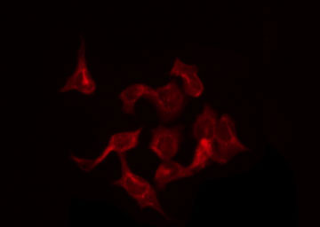 SLC30A1 / ZNT1 Antibody - Staining LOVO cells by IF/ICC. The samples were fixed with PFA and permeabilized in 0.1% Triton X-100, then blocked in 10% serum for 45 min at 25°C. The primary antibody was diluted at 1:200 and incubated with the sample for 1 hour at 37°C. An Alexa Fluor 594 conjugated goat anti-rabbit IgG (H+L) Ab, diluted at 1/600, was used as the secondary antibody.