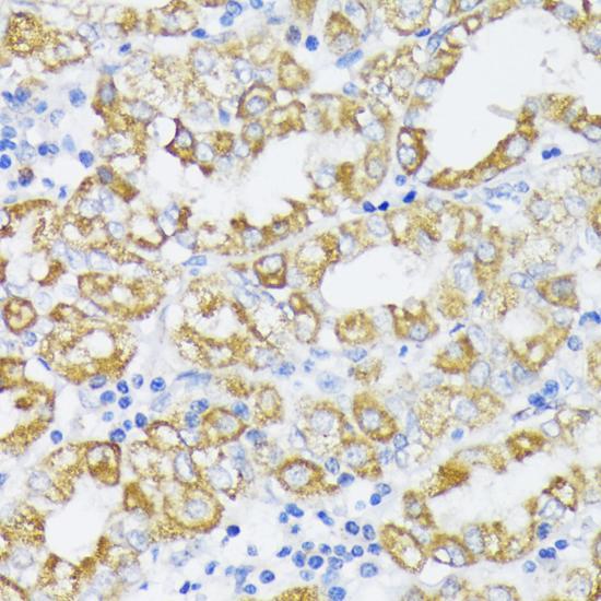 SLC30A1 / ZNT1 Antibody - Immunohistochemistry of paraffin-embedded Human stomach using SLC30A1 Polyclonal Antibody at dilution of 1:100 (40x lens).