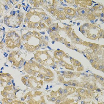 SLC30A1 / ZNT1 Antibody - Immunohistochemistry of paraffin-embedded Human stomach using SLC30A1 Polyclonal Antibody.