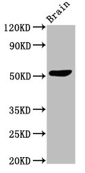 SLC30A10 Antibody - Western Blot Positive WB detected in:Mouse brain tissue All Lanes:SLC30A10 antibody at 3µg/ml Secondary Goat polyclonal to rabbit IgG at 1/50000 dilution Predicted band size: 53,27,25 KDa Observed band size: 53 KDa