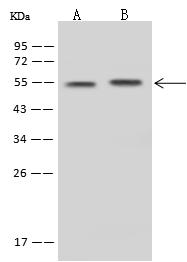 SLC30A10 Antibody - Anti-SLC30A10 rabbit polyclonal antibody at 1:500 dilution. Lane A: Mouse brain tissue lysate Whole Cell Lysate. Lane B: U-251 MG Whole Cell Lysate. Lysates/proteins at 30 ug per lane. Secondary: Goat Anti-Rabbit IgG (H+L)/HRP at 1/10000 dilution. Developed using the ECL technique. Performed under reducing conditions. Predicted band size: 53 kDa. Observed band size: 54 kDa.