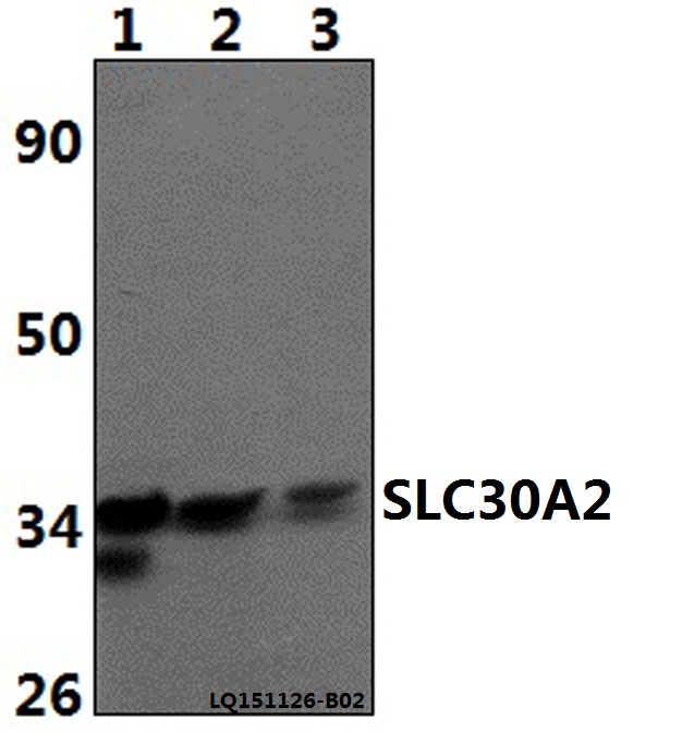 SLC30A2 Antibody - Western blot of SLC30A2 polyclonal antibody at 1:500 dilution. Lane 1: PC12 whole cell lysate (40 ug). Lane 2: HeLa whole cell lysate(40 ug). Lane 3: RAW264.7 whole cell lysate (40 ug).