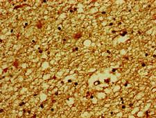 SLC30A3 / ZNT3 Antibody - Immunohistochemistry image of paraffin-embedded human brain tissue at a dilution of 1:100