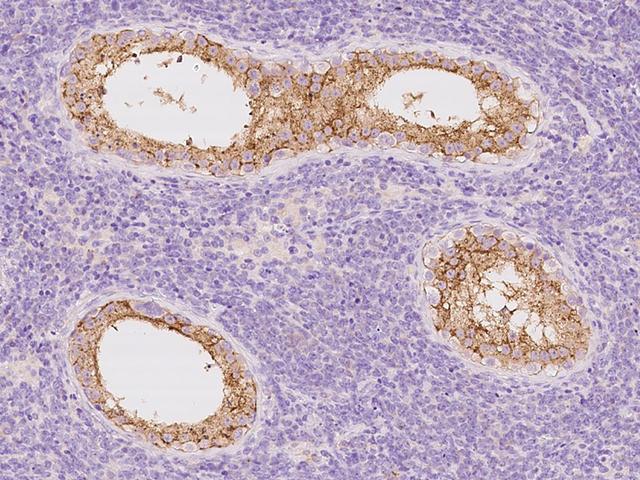 SLC30A3 / ZNT3 Antibody - Immunochemical staining of human SLC30A3 in human testis with rabbit polyclonal antibody at 1:100 dilution, formalin-fixed paraffin embedded sections.