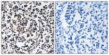 SLC30A4 Antibody - Immunohistochemistry analysis of paraffin-embedded human lymph node tissue, using SLC30A4 Antibody. The picture on the right is blocked with the synthesized peptide.