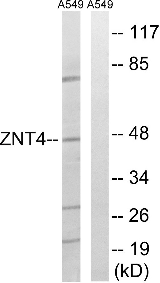 SLC30A4 Antibody - Western blot analysis of lysates from A549 cells, using SLC30A4 Antibody. The lane on the right is blocked with the synthesized peptide.