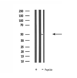 SLC30A4 Antibody - Western blot analysis of extracts of A549 cells using SLC30A4 antibody.