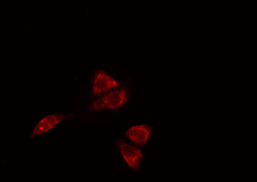 SLC30A4 Antibody - Staining A549 cells by IF/ICC. The samples were fixed with PFA and permeabilized in 0.1% Triton X-100, then blocked in 10% serum for 45 min at 25°C. The primary antibody was diluted at 1:200 and incubated with the sample for 1 hour at 37°C. An Alexa Fluor 594 conjugated goat anti-rabbit IgG (H+L) antibody, diluted at 1/600, was used as secondary antibody.