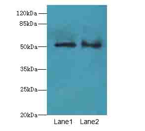 SLC30A6 Antibody - Western blot. All lanes: SLC30A6 antibody at 6 ug/ml. Lane 1: A549 whole cell lysate. Lane 2: U251 whole cell lysate. Secondary Goat polyclonal to Rabbit IgG at 1:10000 dilution. Predicted band size: 51 kDa. Observed band size: 51 kDa.