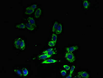 SLC30A6 Antibody - Immunofluorescent analysis of HepG2 cells using SLC30A6 Antibody at dilution of 1:100 and Alexa Fluor 488-congugated AffiniPure Goat Anti-Rabbit IgG(H+L)