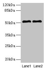 SLC30A6 Antibody - Western blot All lanes: SLC30A6 antibody at 6µg/ml Lane 1: A549 whole cell lysate Lane 2: U251 whole cell lysate Secondary Goat polyclonal to rabbit IgG at 1/10000 dilution Predicted band size: 52, 56, 48, 49 kDa Observed band size: 52 kDa