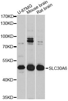 SLC30A6 Antibody - Western blot analysis of extracts of various cell lines, using SLC30A6 Antibody at 1:3000 dilution. The secondary antibody used was an HRP Goat Anti-Rabbit IgG (H+L) at 1:10000 dilution. Lysates were loaded 25ug per lane and 3% nonfat dry milk in TBST was used for blocking. An ECL Kit was used for detection and the exposure time was 30s.