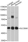 SLC30A6 Antibody - Western blot analysis of extracts of various cell lines, using SLC30A6 Antibody at 1:3000 dilution. The secondary antibody used was an HRP Goat Anti-Rabbit IgG (H+L) at 1:10000 dilution. Lysates were loaded 25ug per lane and 3% nonfat dry milk in TBST was used for blocking. An ECL Kit was used for detection and the exposure time was 30s.