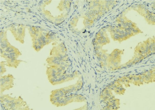 SLC30A6 Antibody - 1:100 staining mouse colon tissue by IHC-P. The sample was formaldehyde fixed and a heat mediated antigen retrieval step in citrate buffer was performed. The sample was then blocked and incubated with the antibody for 1.5 hours at 22°C. An HRP conjugated goat anti-rabbit antibody was used as the secondary.