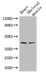 SLC30A7 Antibody - Positive WB detected in:Mouse heart tissue,Mouse skeletal muscle tissue;All lanes: SLC30A7 antibody at 3ug/ml;Secondary;Goat polyclonal to rabbit IgG at 1/50000 dilution;Predicted band size: 42 kDa;Observed band size: 42 kDa;