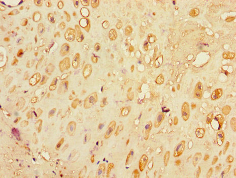 SLC30A7 Antibody - Immunohistochemistry of paraffin-embedded human placental tissue using SLC30A7 Antibody at dilution of 1:100