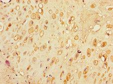 SLC30A7 Antibody - Immunohistochemistry of paraffin-embedded human placental tissue using SLC30A7 Antibody at dilution of 1:100