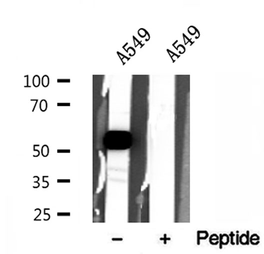 SLC30A7 Antibody - Western blot analysis of extracts of A549 cells using ZnT7 antibody.