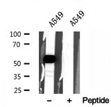 SLC30A7 Antibody - Western blot analysis of extracts of A549 cells using ZnT7 antibody.