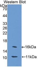 SLC30A8 / ZNT8 Antibody - Western Blot; Sample: Recombinant protein.